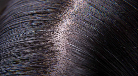 Quelles sont les causes d'un cuir chevelu irrité ? Comprendre le microbiome du cuir chevelu et ce qui rend votre cuir chevelu sensible